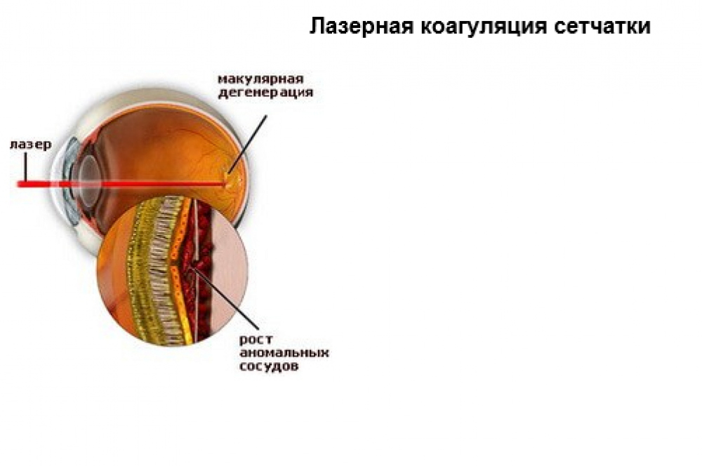 Сетчатка место расположения. Сетчатка зародышевый листок. Слой нервных волокон сетчатки. Сетчатка глаза зародышевый листок.