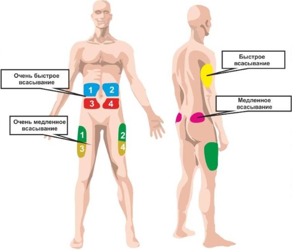 Подкожная инъекция в плечо, живот, бедро. Техника выполнения, введения