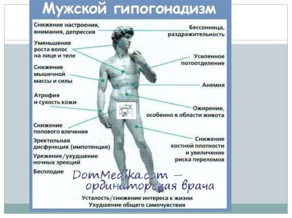 Синдром кальмана презентация