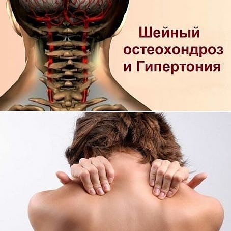 Некоторые причины боли в шее