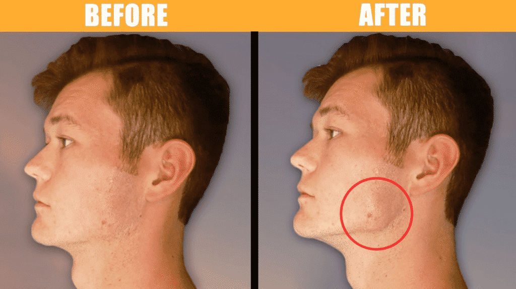 how-to-get-a-jawline-8-1024x574 How To Get A Chiseled Jawline? 20+ Exercises & Tools To Use
