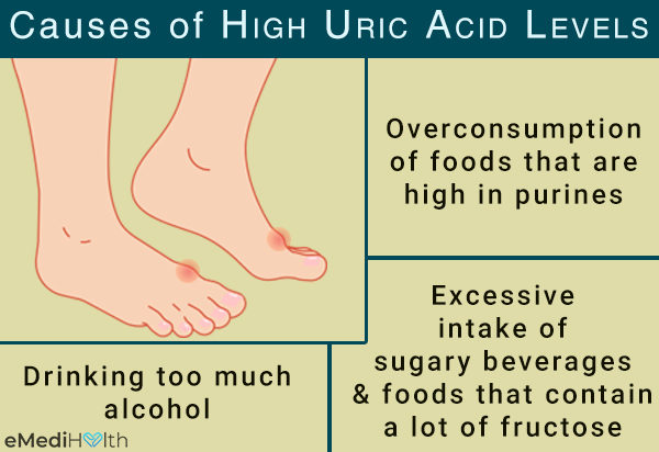 causes of high uric acid levels